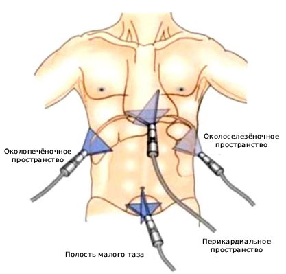 FAST-протокол