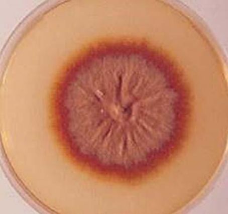 Рост одного из видов гриба Trichophyton на среде Сабуро [3]