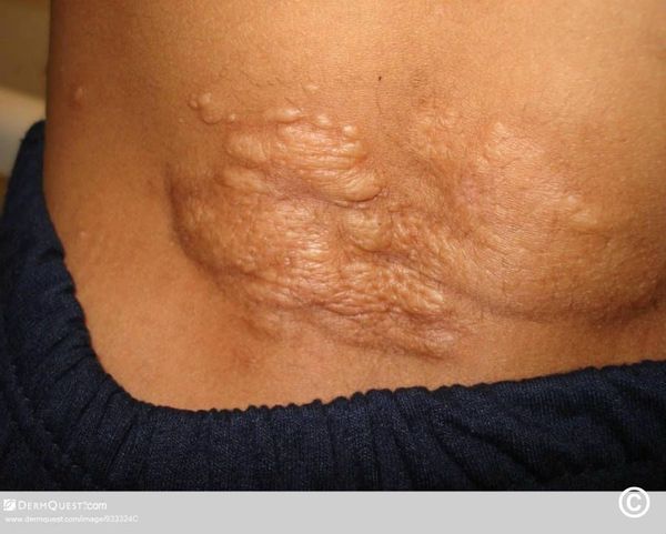 «Шагреневая кожа» [29]