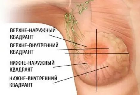 Квадранты молочной железы