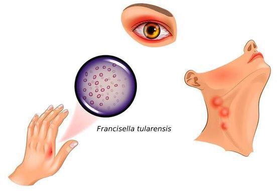 Francisella tularensis — возбудитель туляремии