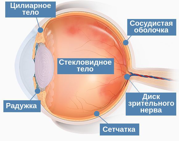 Воспаление оболочек глаза при увеите