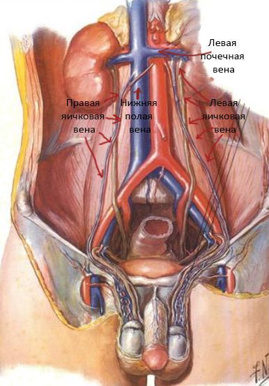 Варикоцеле: фото, причины, симптомы, лечение, в т.ч. операция