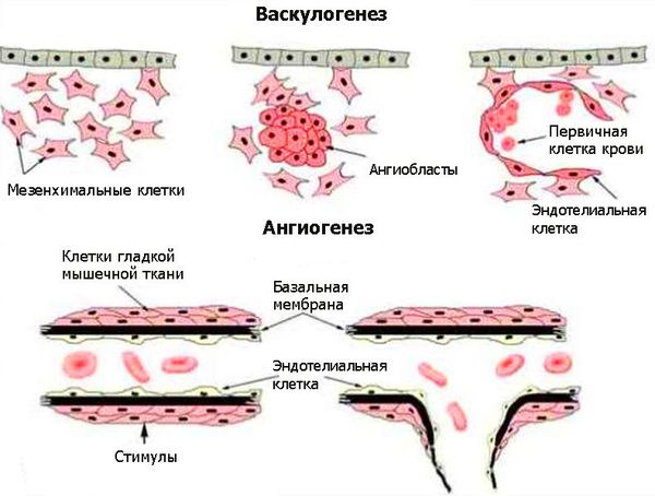 Артерио-венозная мальформация