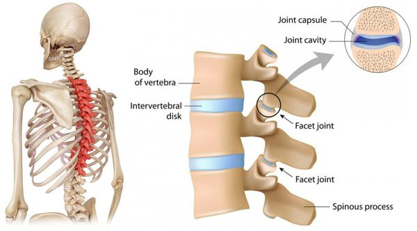 Дистрофическое поражение грудного отдела позвоночника и область болевого синдрома