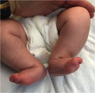 Двусторонняя стопа-качалка [10]