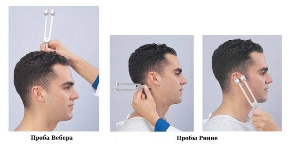 Камертональные пробы [20]