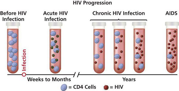 Прогрессирование ВИЧ