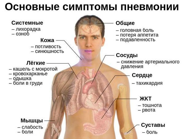 Основные симптомы пневмонии