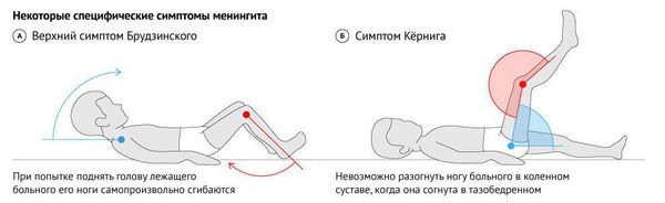 вирусный менингоэнцефалит что это. Смотреть фото вирусный менингоэнцефалит что это. Смотреть картинку вирусный менингоэнцефалит что это. Картинка про вирусный менингоэнцефалит что это. Фото вирусный менингоэнцефалит что это