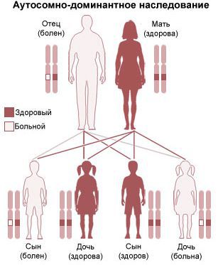 » Врожденный стридор у детей