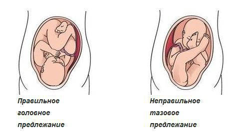 Дисплазия шейки матки: развитие и лечение