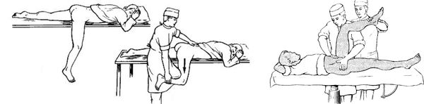 Методы вправления