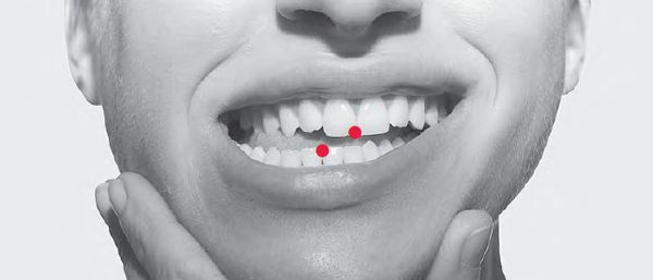 Боль в челюсти – симптомы, причины, лечение