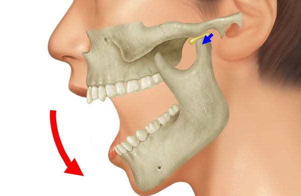 Можно ли вывихнуть челюсть при зевании – информация для пациентов