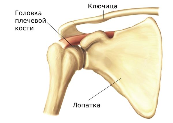 Плечо вылетело из сустава: причины, лечение