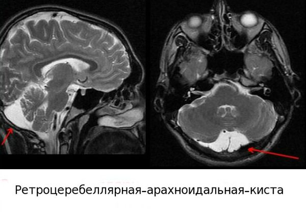 Причины задержки речевого развития ребенка