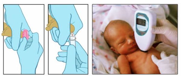 Физиологическая желтуха новорожденных что это