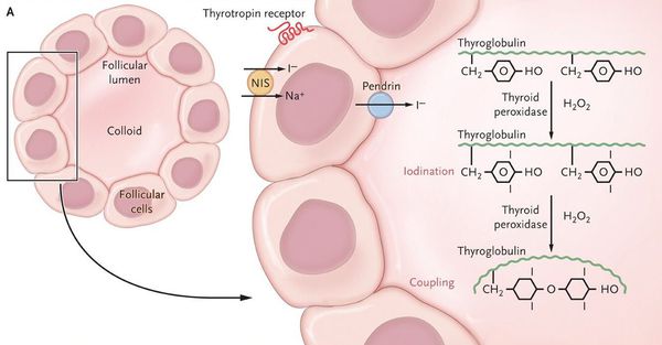 Увеличение синтеза тиреотропных гормонов в гипоталамусе