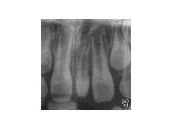 Ортопантомограмма (в увеличенном виде) Ортопантомограмма (в увеличенном виде)