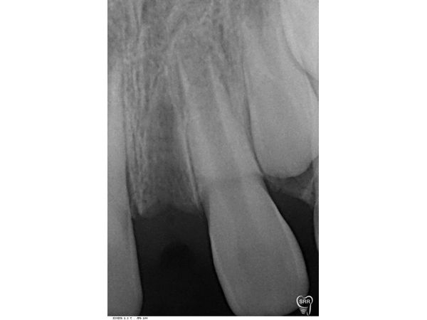 Контрольный снимок после удаления Контрольный снимок после удаления