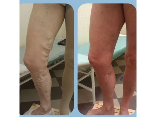 Ситуация до и после лечения 