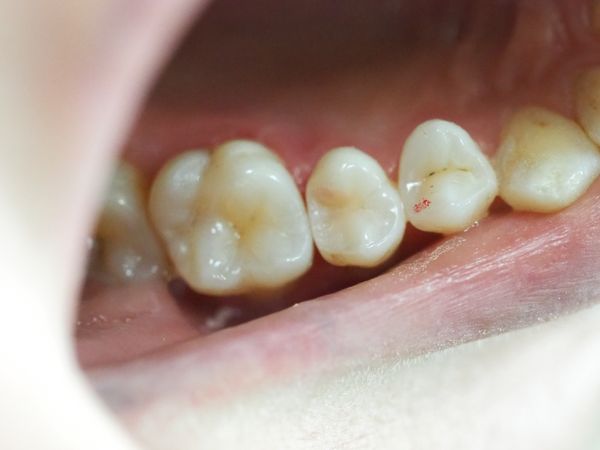 Результат лечения