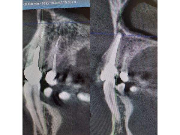 Динамическое наблюдение Динамическое наблюдение