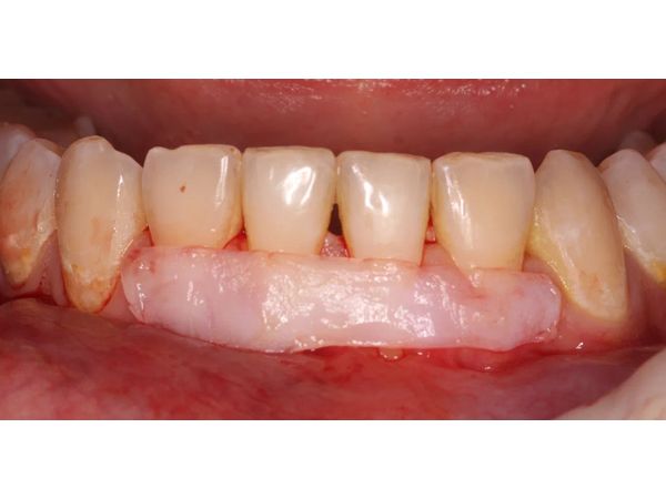 Ход операции Ход операции