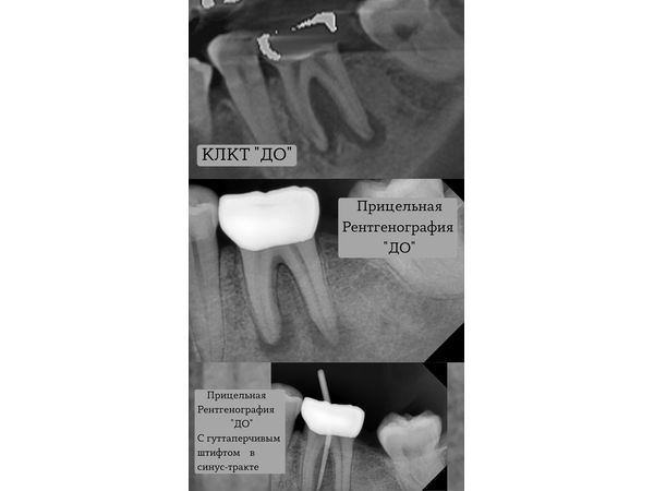 Диагностика до лечения Диагностика до лечения