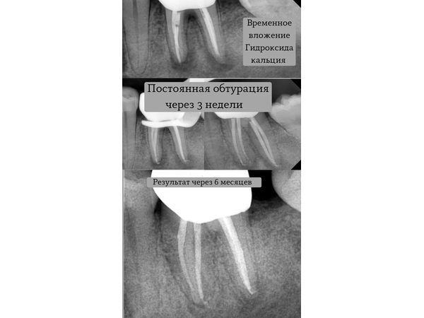 Фото минет через отверстие