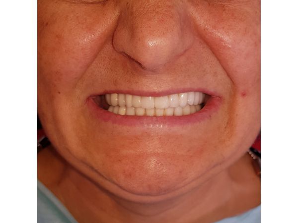 Результат лечения