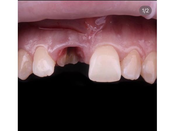 Исходная ситуация Исходная ситуация