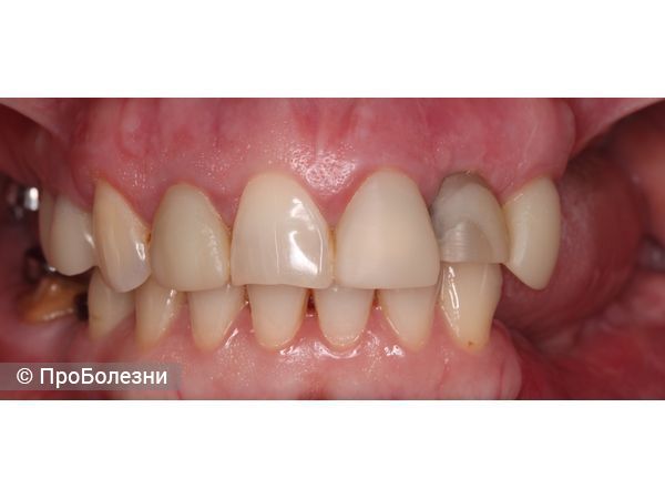 Исходная ситуация