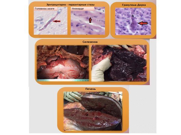 Результаты патоморфологического исследования