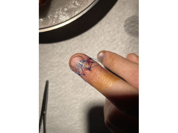 Ситуация после операции