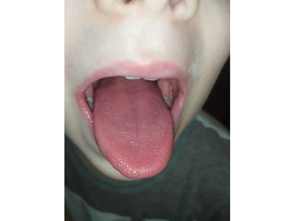 «Малиновый» язык