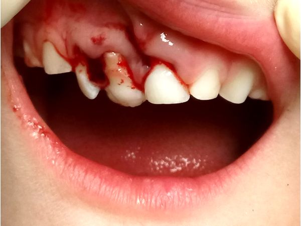 Исходная ситуация при обращении Исходная ситуация при обращении