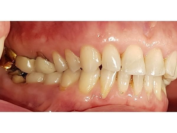 До лечения: вид справа