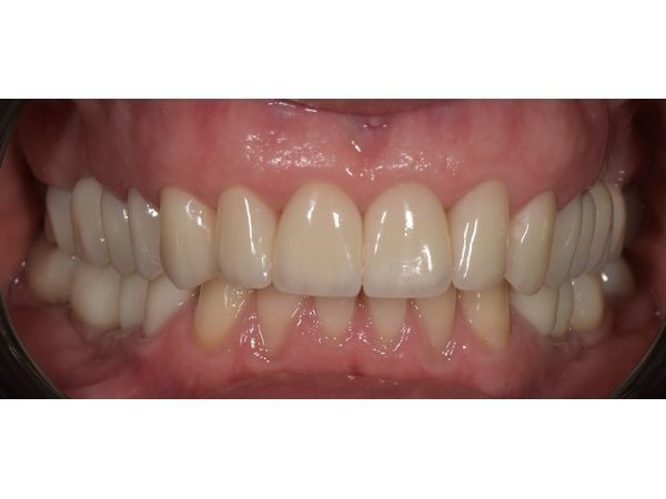 Картина после лечения