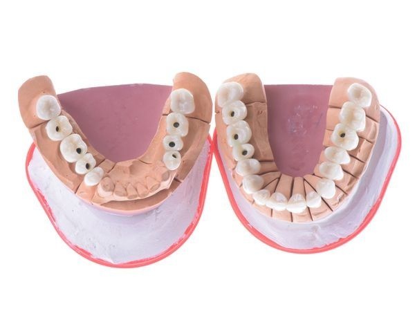 Новые зубы на моделях