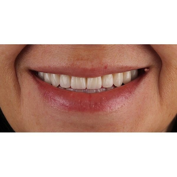 После лечения