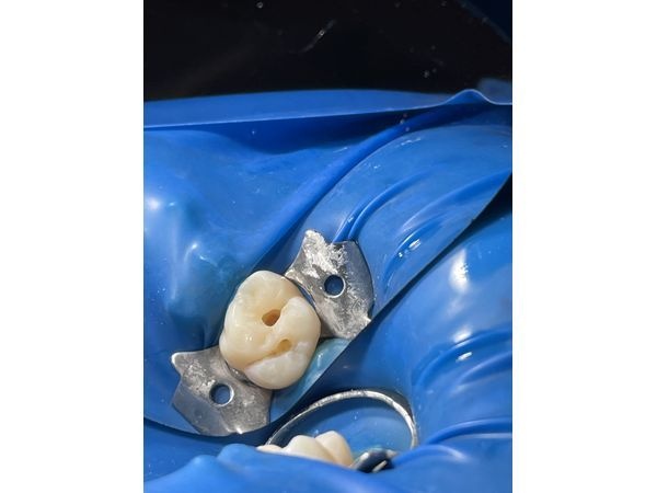 Во время лечения