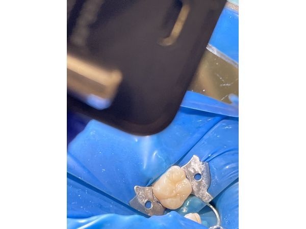 После лечения