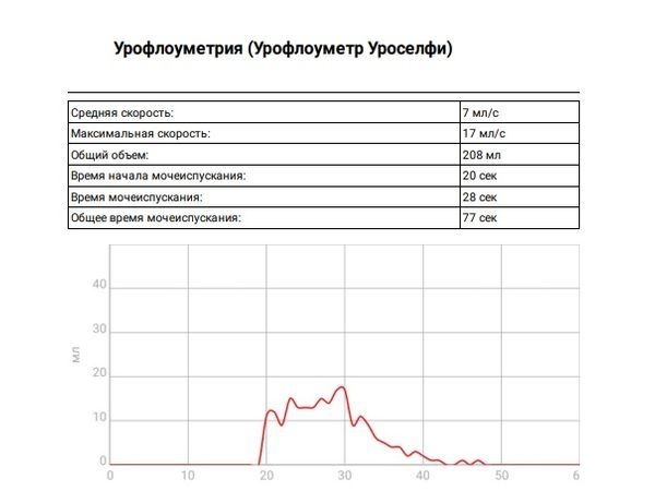 Предстательная железа