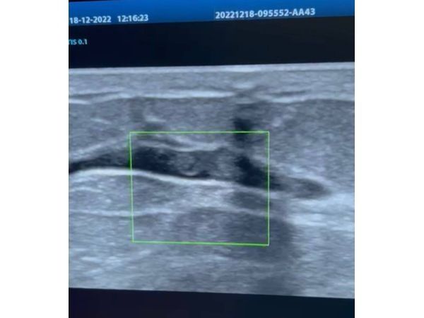 Внутрипротоковая структура 