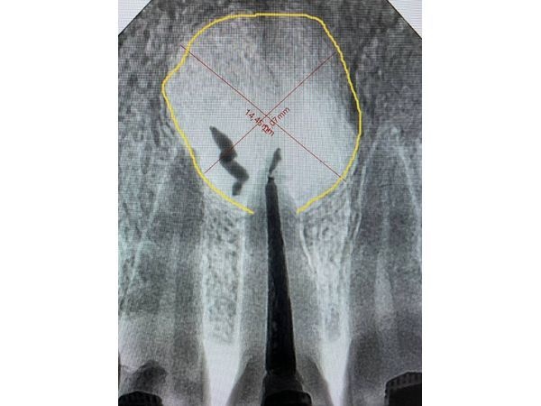 Размеры образования 