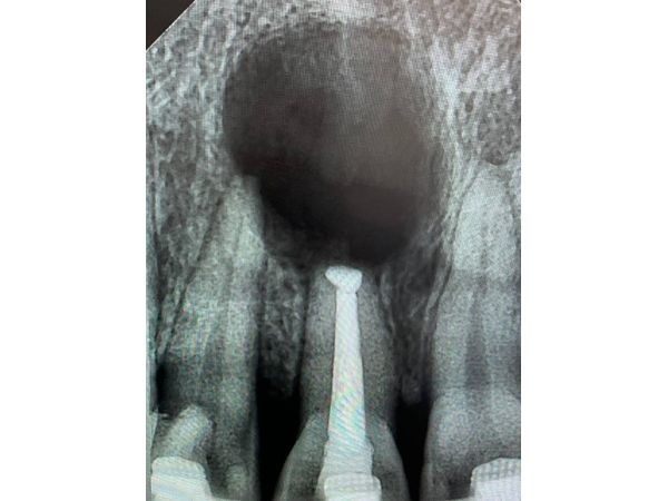 Контрольный снимок 