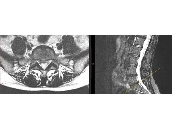 МРТ-картина МРТ-картина
