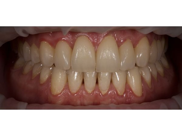 Результат лечения